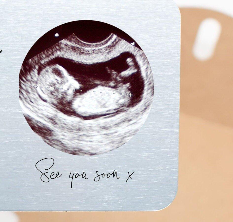 Personalised Baby Scan Gift, Baby Announcement Gift, Baby Ultrasound Picture Gift, Pregnancy Scan Card,